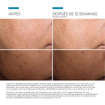 Skinceuticals Discoloration Defense - Imagen 2
