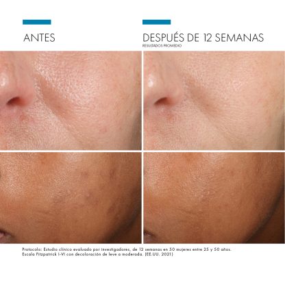 Skinceuticals  Phloretin  CF SERUM - Imagen 2