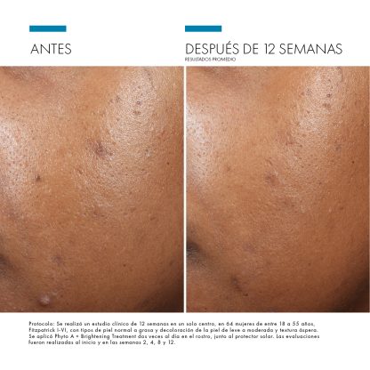 Skinceuticals PHYTO A+ BRIGHTENING TREATMENT 30 ML - Imagen 2