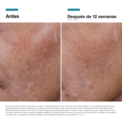 Skinceuticals HA Intensifier Multi-Glycan 30 ML - Imagen 5