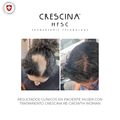 CRESCINA TRANSDERMIC HFSC RE-GROWTH 500 WOMAN - Imagen 2