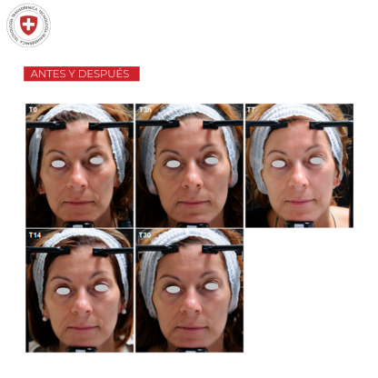 Fillerina 12HA Densifying-Filler Intensive Treatment Grade 3 - Imagen 7
