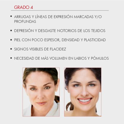 Fillerina 12HA Densifying-Filler Intensive Treatment Grade 4 - Imagen 9
