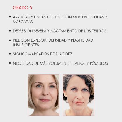 Fillerina 12HA Densifying-Filler Intensive Treatment Grade 5 - Imagen 8