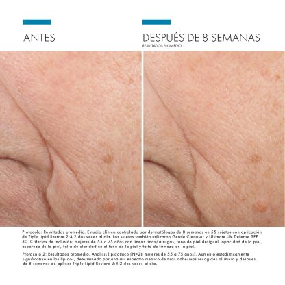 Skinceuticals Triple Lipid Restore 2:4:2 - Imagen 2